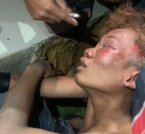 Lacak Motor Curian Lewat Facebook, Warga Batam Berakhir Bersimbah Darah 