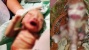 Kasihan, Bayi Ini Lahir Dalam Kondisi Memprihatinkan