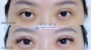 Promo Eska Salon dan Spa, Eska Facial 2 in 1 + Eye Lashses Free Konsultasi dengan Dokter Kulit 